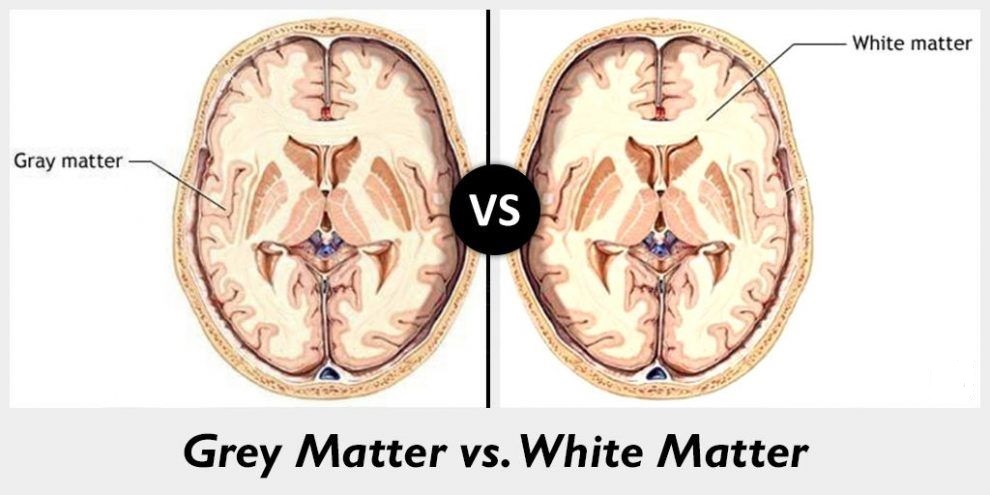 تفاوت ماده سفید و خاکستری مغز